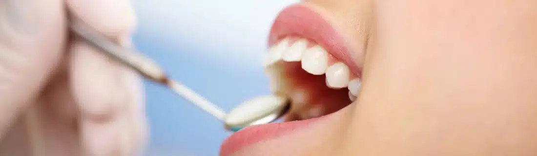 Dentist Cleaning Teeth CS1