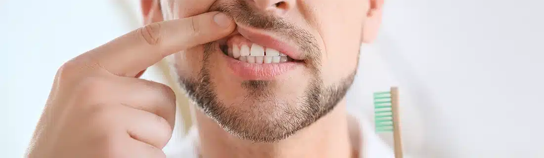 Dentist Man Practicing Gingivitis Prevention CS1