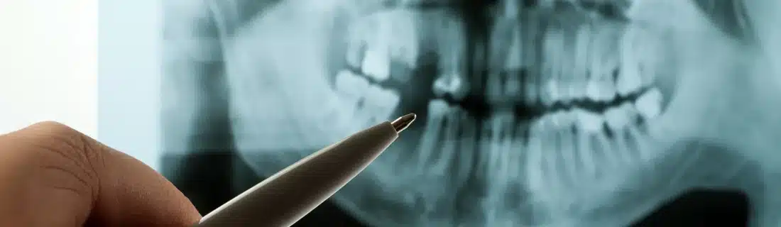 Dentist Richmond TX Digital X Rays