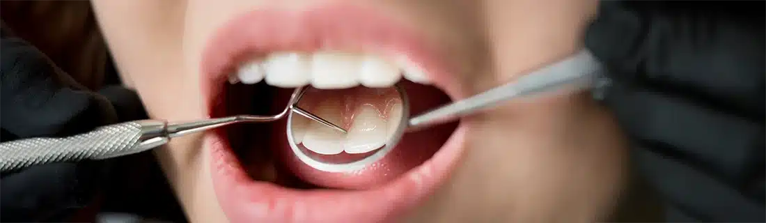 Dentist Woman At Dentist Getting Check Up CS1