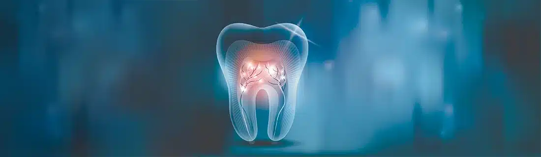 Transparent Tooth Root Canal Illustration CS1